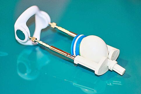 Endeffekt - en Apparat fir eng effektiv Erhéijung vun engem Member